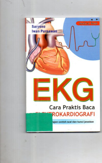 Cara Praktis Baca Elektrokardiografi (EKG)
